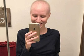 Người đẹp thể hình tiết lộ ảnh sốc sau khi bị ung thư