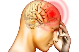 Tự bấm huyệt đánh tan đau đầu trong 5 phút không cần thuốc