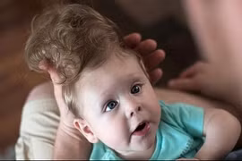 Sống sót thần kỳ dù bị não lồi ra ngoài hộp sọ