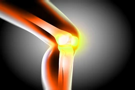 Bài thuốc từ quả dứa cho xương chắc khỏe