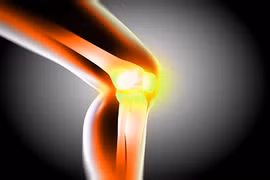 Bài thuốc từ quả dứa cho xương chắc khỏe