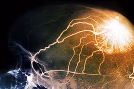 Hoạt động phức tạp của cơ thể con người khi chết não