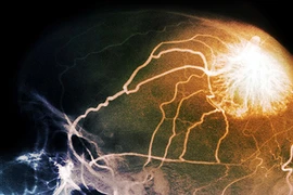 Hoạt động phức tạp của cơ thể con người khi chết não