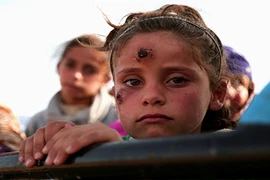 Top bệnh lây nhiễm mới xuất hiện cần cẩn trọng năm 2017