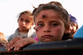 Top bệnh lây nhiễm mới xuất hiện cần cẩn trọng năm 2017