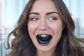 Thực hư chuyện làm trắng răng bằng than hoạt tính