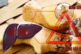 Top thực phẩm gây ngộ độc nếu không dùng đúng cách