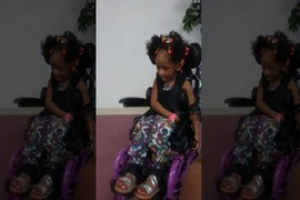 Cô bé 4 tuổi phải ngồi xe lăn cả đời sau khi nhổ răng