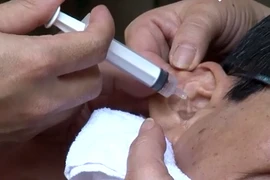 Các bước xử trí khi có dị vật trong tai