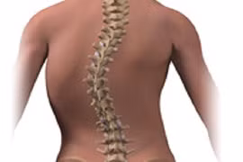 Video: Cận cảnh quá trình phẫu thuật vẹo cột sống