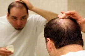 Những thực phẩm tốt cho mái tóc nên bổ sung ngay