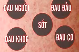 Những loại thuốc không được dùng khi sốt xuất huyết