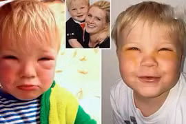 Bé trai bị mù tạm thời vì thuốc nhuộm tóc của mẹ 