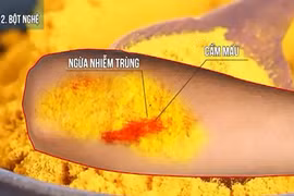 6 cách cầm máu vết thương nhanh chóng tại nhà