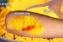 6 cách cầm máu vết thương nhanh chóng tại nhà