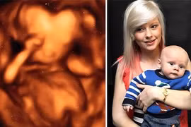 Top 10 hình ảnh siêu âm thai gây tò mò nhất