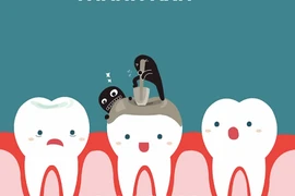 Răng sâu hình thành và phát triển như thế nào?