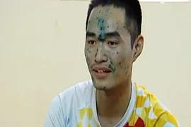 Nam sinh bảo vệ tốt nghiệp trong bộ dạng “người ngoài hành tinh”