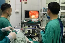 Cắt bỏ khối u cơ thực quản đường miệng không cần phẫu thuật