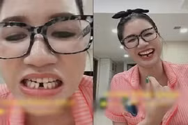 Cười xỉu lý do khiến Trang Trần gãy răng cửa