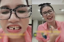 Cười xỉu lý do khiến Trang Trần gãy răng cửa