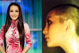 Ảnh cũ Linh Nga đầu trọc khiến nhiều người sửng sốt