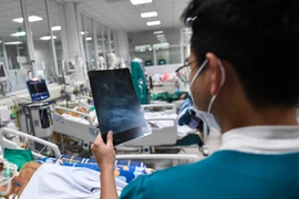 Viêm não mô cầu nguy hiểm thế nào?