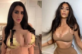 Cô gái trải qua chục lần "dao kéo" để giống Kim Kardashian