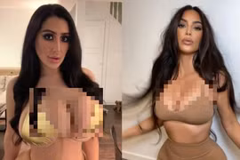 Cô gái trải qua chục lần "dao kéo" để giống Kim Kardashian