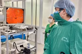 Người phụ nữ nuốt cả bàn chải đánh răng... khi “giải cứu” nghẹn họng