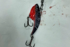 Người đàn ông bị lưỡi câu móc vào nhãn cầu khi đi câu cá