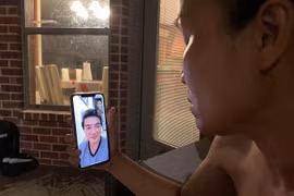 Đàm Vĩnh Hưng tiết lộ ảnh cận mặt bị bỏng nặng của Hồng Ngọc 