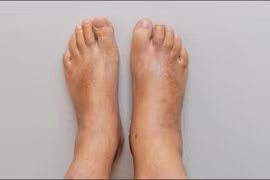 Chân có dấu hiệu này coi chừng phổi của bạn đang gặp vấn đề