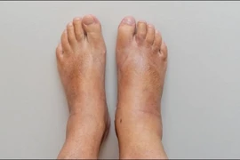 Chân có dấu hiệu này coi chừng phổi của bạn đang gặp vấn đề