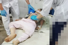 Bé gái 5 tuổi suy hô hấp nguy kịch vì hóc quả nhãn