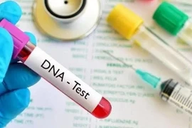 Chồng lén lấy tóc của con đi xét nghiệm ADN làm tôi ngã quỵ