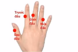 Kích thích huyệt đạo hiệu quả với bệnh nhân đau đầu