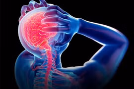 Đau nửa đầu tiềm ẩn nguy cơ đột quỵ não