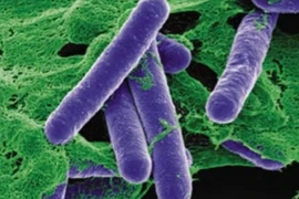 Thanh niên liệt tứ chi vì ăn pate, cách nhận biết ngộ độc botulinum 