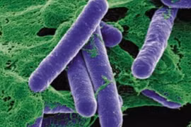 Thanh niên liệt tứ chi vì ăn pate, cách nhận biết ngộ độc botulinum 