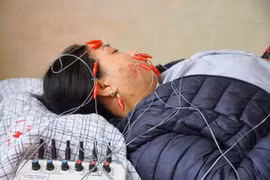 Nhiều người liệt mặt biến chứng do thời tiết lạnh, cách phòng tránh