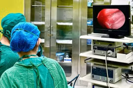 Viêm xoang do nấm cẩn thận biến chứng nguy hiểm gây mù lòa