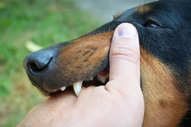 Bé 3 tuổi bị chó cắn vỡ thận 