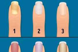 Dấu hiệu trên móng tay cảnh báo cơ thể thiếu vitamin quan trọng