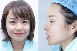 Thái Trinh thừa nhận sửa mũi, cắt mí để cải thiện nhan sắc