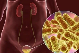 Bị viêm bàng quang có nên quan hệ tình dục?