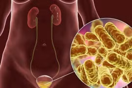 Bị viêm bàng quang có nên quan hệ tình dục?