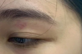 Nhân viên quán bánh mì Nguyên Sinh đánh khách: Chuyển hồ sơ công an quận