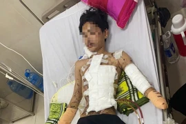Nam thanh niên mất bàn tay vì tự chế pháo nổ
