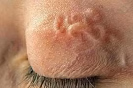 Cảnh báo nguy cơ nhiễm ký sinh trùng từ “thú cưng” 